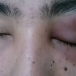 images (6)